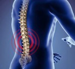 10 thói quen xấu gây đau lưng