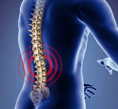 10 thói quen xấu gây đau lưng